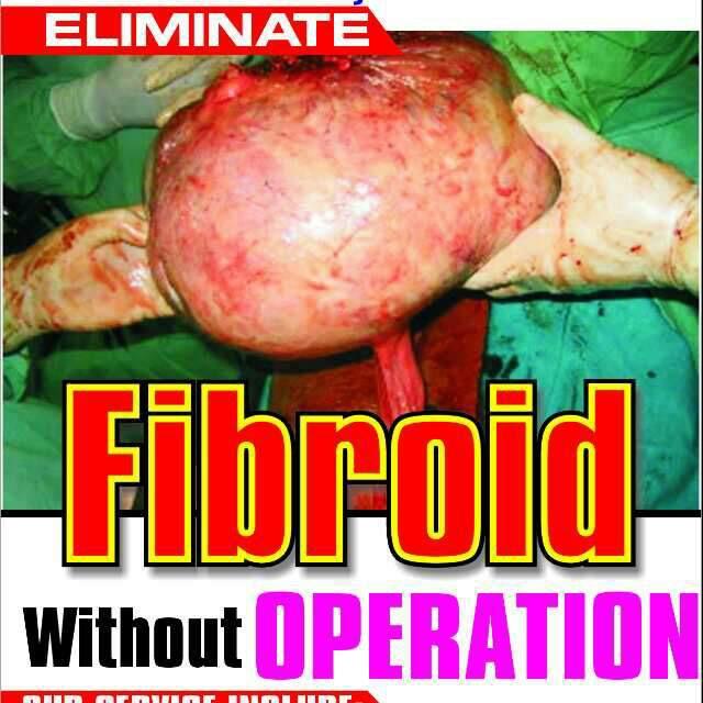 eliminate fibroid without operation - Greenlife Africa
